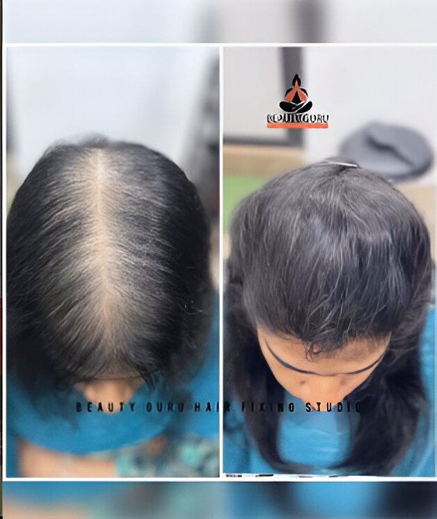 Hair Transformation